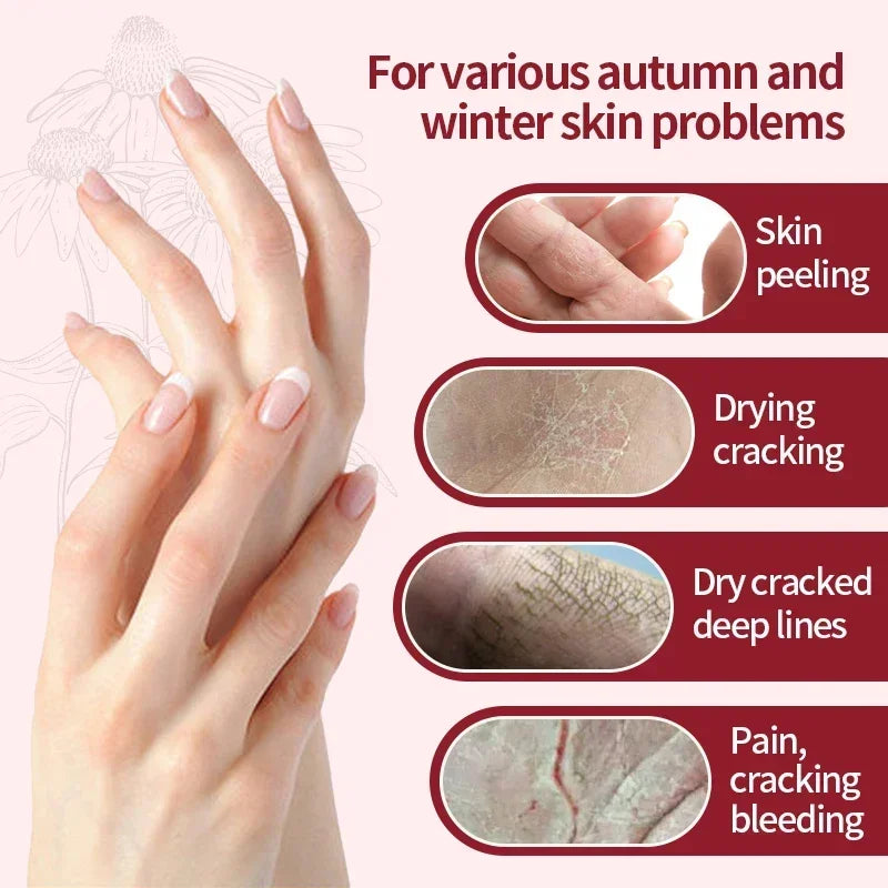 Wrinkle Removal Anti-Crack Hand Cream Moisturize Exfoliating Repair Hand Lotion Anti-Aging Nourish Anti-drying Whiten Hand Care