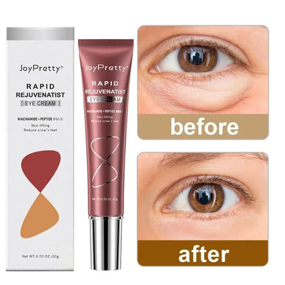 Instant Eye Cream Dark Circles Remover Eye Bags Anti-Wrinkle Firmness Whitening Under Eyes Serum Beauty Health Skin Care Product